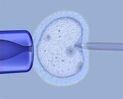 代孕服务包成功,泰国试管婴儿医院推荐：泰国试管婴儿取卵的过程