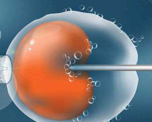 子宫脱垂，没有选择产康的我怎么样了