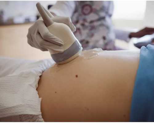 试管婴儿包男孩吗苏州肯定找康贝贝 好