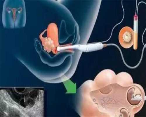 绝经后可以代孕吗,郑州三代试管的费用标准