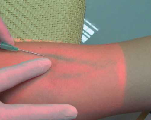 国内供精费用，吃优甲乐会影响生育吗